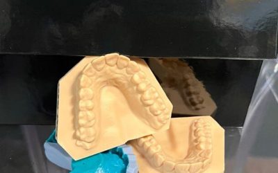 Digital smile Design