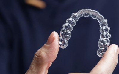 L&rsquo;ORTHODONTIE INVISIBLE : RÉALIGNER VOS DENTS EN TOUTE DISCRÉTION