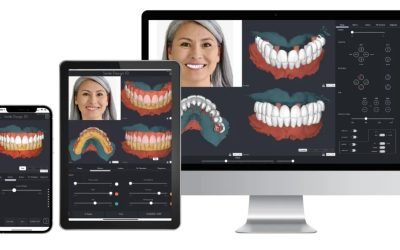 L’intelligence artificielle révolutionne la dentisterie à Montauban