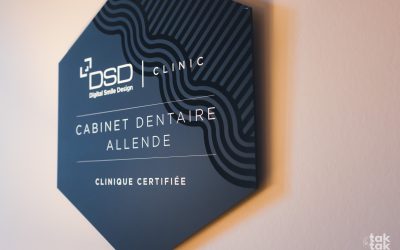 La chirurgie guidée en implantologie : comment se déroule la pose de vos implants à Montauban